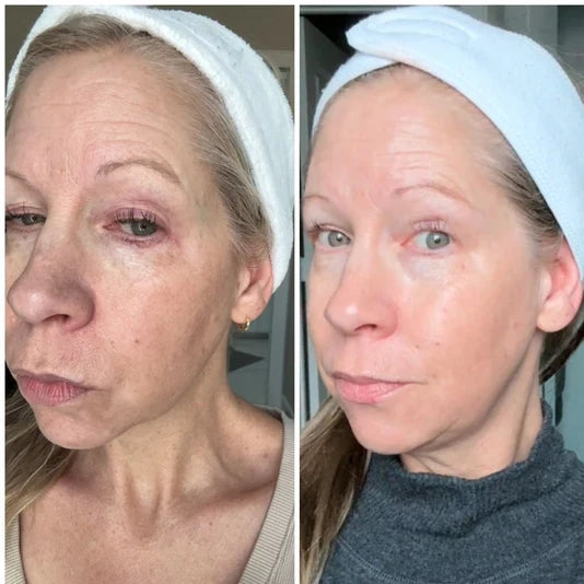 Before and after photo