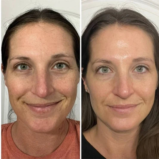 Before and after photo