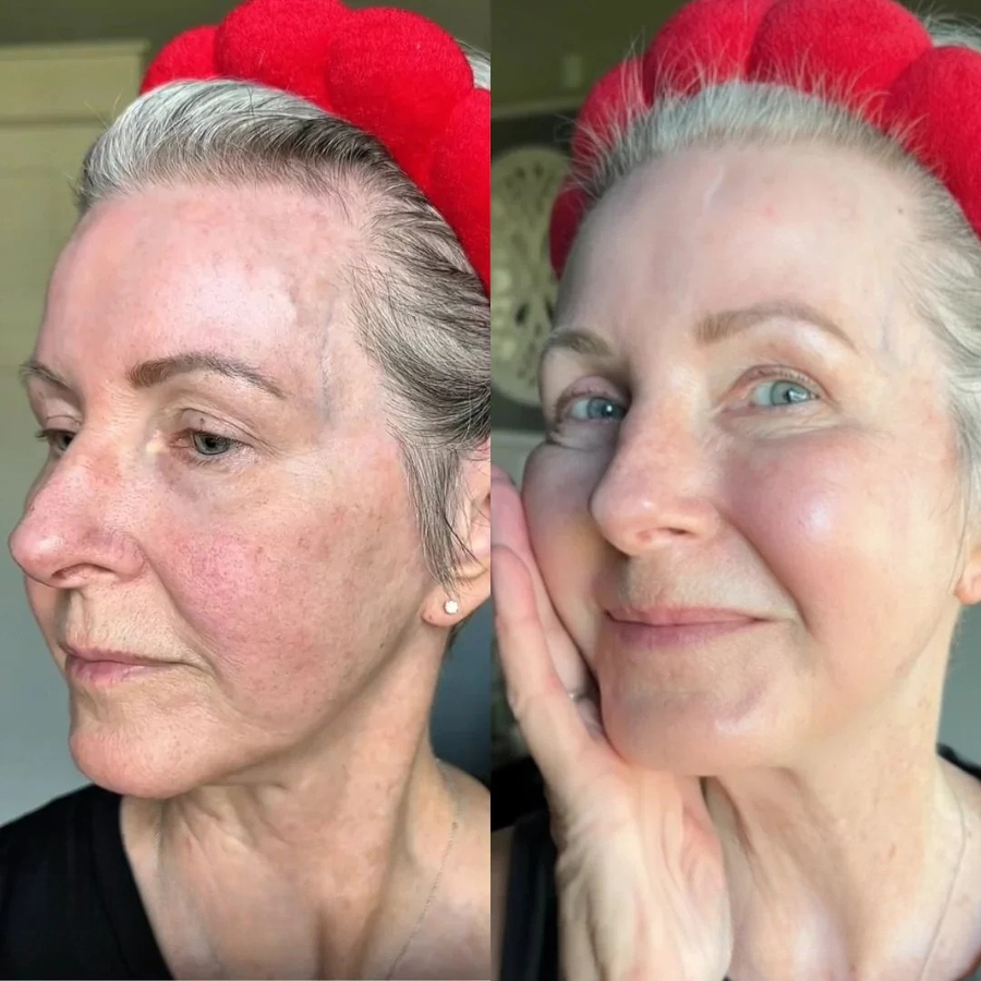 Before and after photo